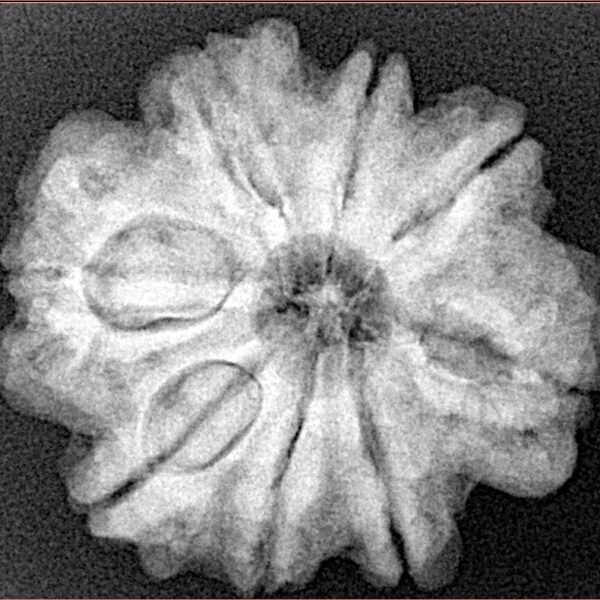 8 Mukhi Rudraksha 25.8mm 5.36gm - Xray