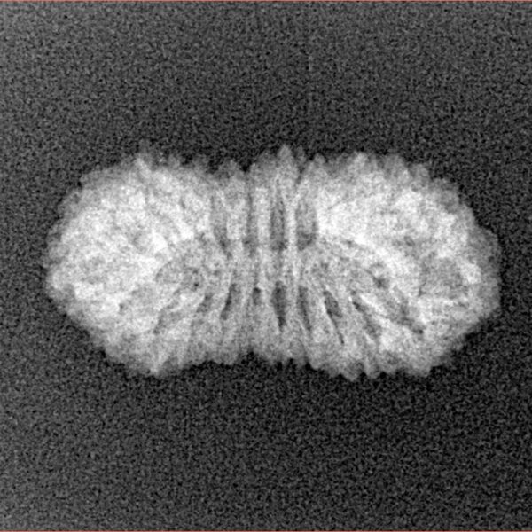 22 Mukhi Rudraksha 22mm 1.61gm - Xray