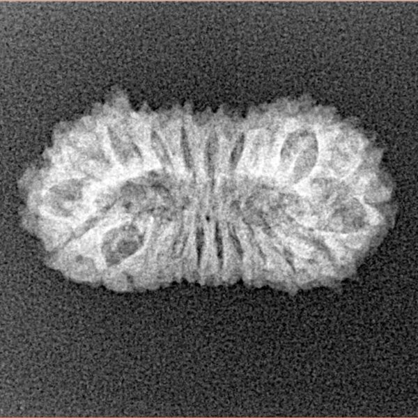 21 Mukhi Rudraksha 23mm 1.76gm - Xray