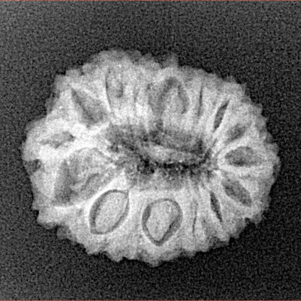 16 Mukhi Rudraksha 21.7mm 2.44gm - Xray