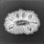 20 Mukhi Rudraksha 21.8mm 2gm - Xray