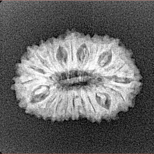 20 Mukhi Rudraksha 21.8mm 2gm - Xray