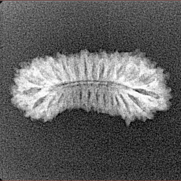 27 Mukhi Rudraksha 23.1mm 1.23gm - Xray
