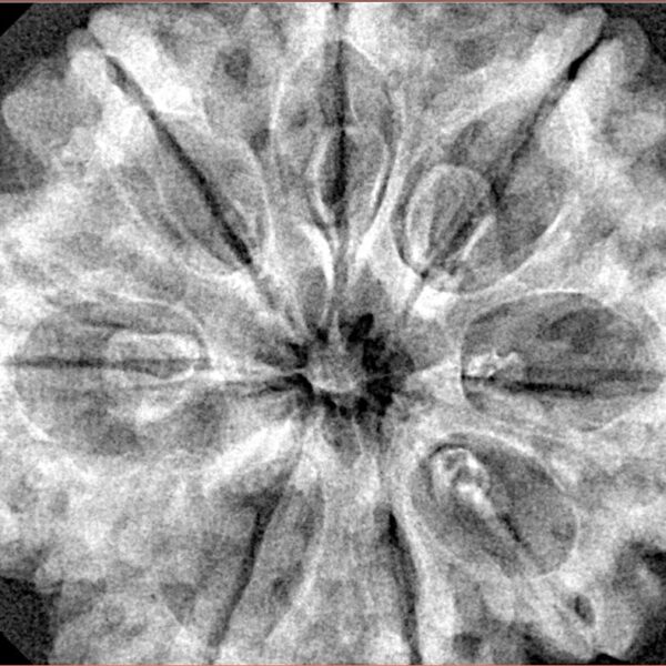 8 Mukhi Rudraksha 33mm 8gm - Xray