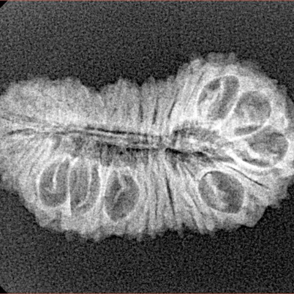 30 Mukhi Rudraksha 28mm 2.54gm - Xray