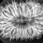 18 Mukhi Rudraksha 34mm 5.72gm - Origin: Nepal - Xray