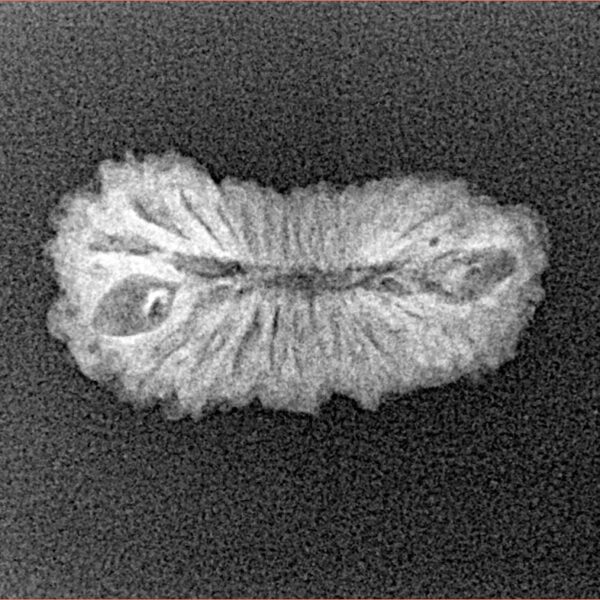 25 Mukhi Rudraksha 21.5mm 1.23gm - Xray