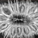 17 Mukhi Rudraksha 35.7mm 7.48gm - Xray