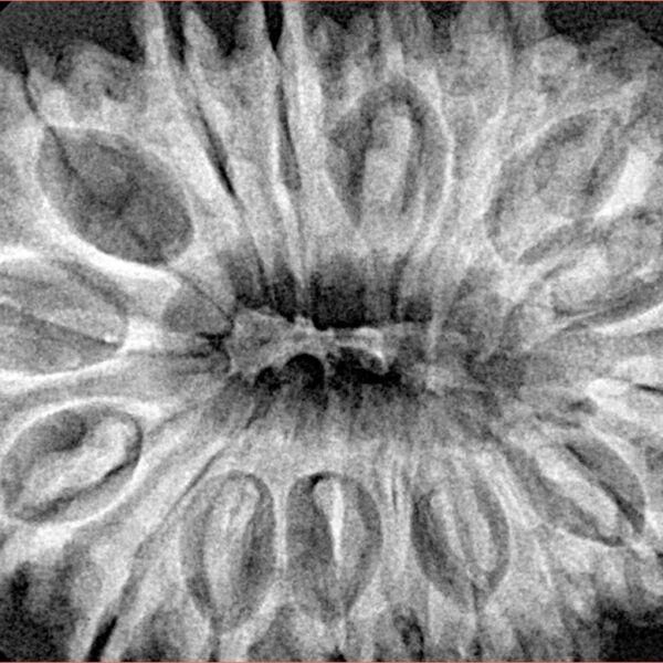 17 Mukhi Rudraksha 35.7mm 7.48gm - Xray