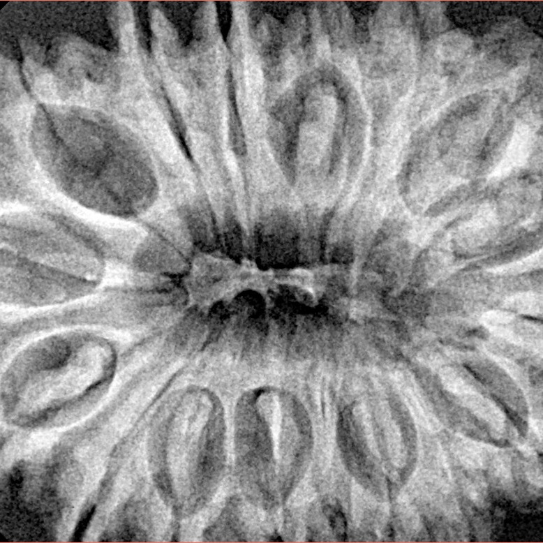 17 Mukhi Rudraksha 35.7mm 7.48gm - Xray