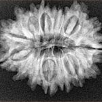16 Mukhi Rudraksha 27.9mm 4.15gm - Xray