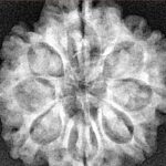 8 Mukhi Rudraksha 25.8mm 5.23gm - Xray