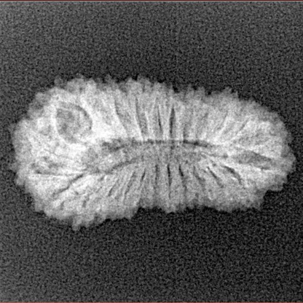 25 Mukhi Rudraksha 24.1mm 1.9gm - Xray
