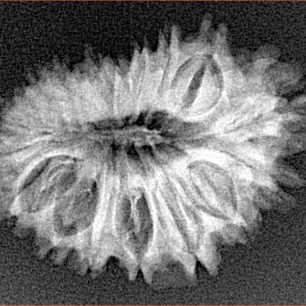 18 Mukhi Rudraksha 25.7mm 3.15gm - Xray