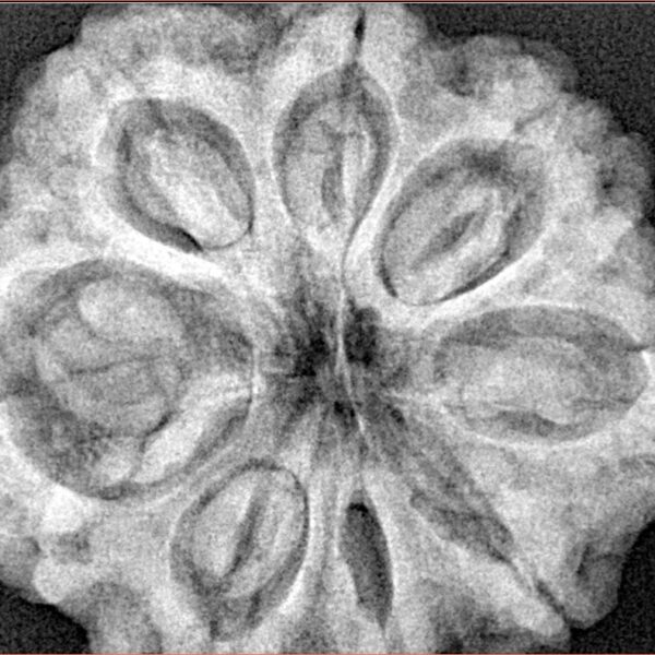 8 Mukhi Rudraksha 32.5mm 8.29gm - Xray