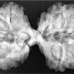 10 Mk Gaurishankar 42.3mm 9.46gm - Xray