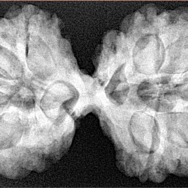 10 Mk Gaurishankar 42.3mm 9.46gm - Xray