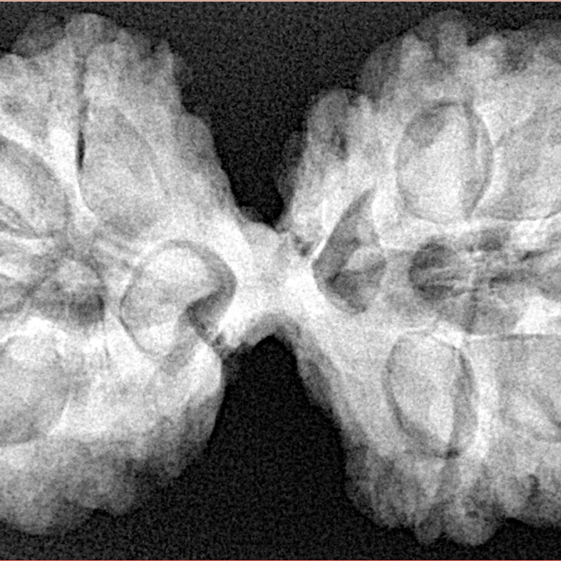 10 Mk Gaurishankar 42.3mm 9.46gm - Xray