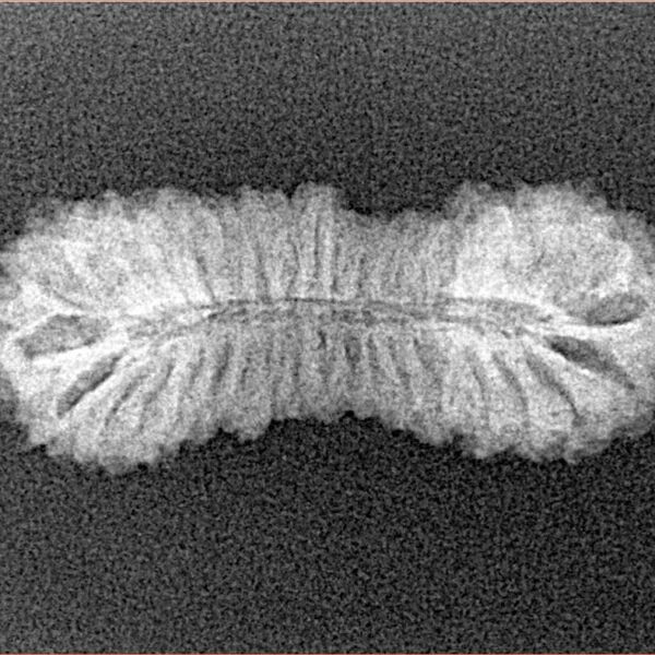 38 Mukhi Rudraksha 28.1mm 1.77gm - Xray