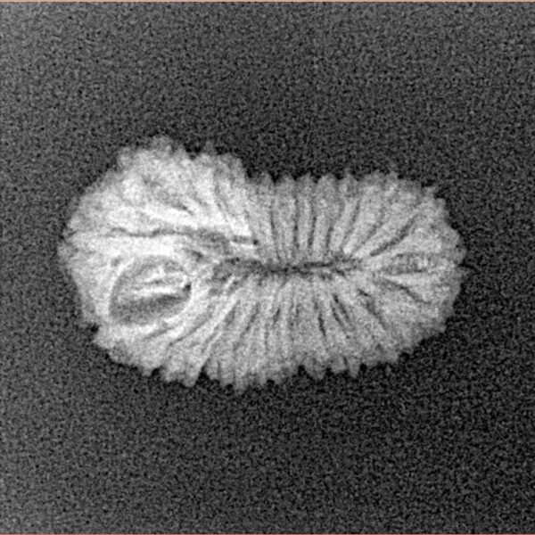 22 Mukhi Rudraksha 19.5mm 1.14gm - Xray