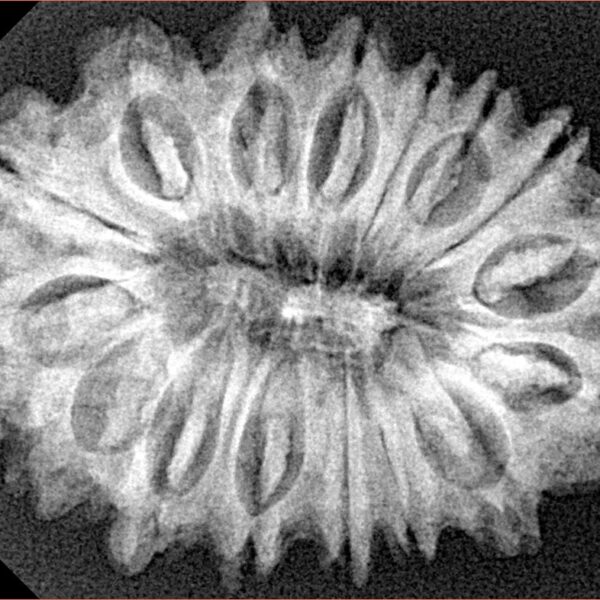 16 Mukhi Rudraksha 30.5mm 5.24gm - Xray
