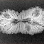 26 Mukhi Rudraksha 31.3mm 3.43gm - Xray