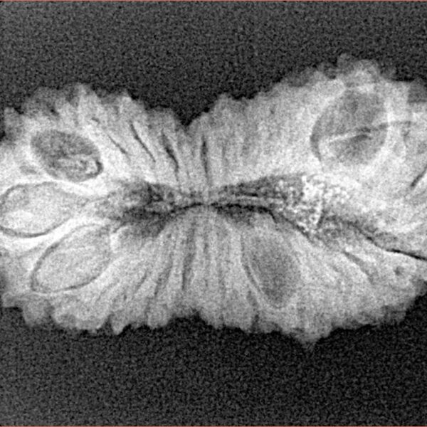 26 Mukhi Rudraksha 31.3mm 3.43gm - Xray