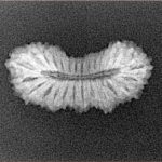 27 Mukhi Rudraksha 23.4mm 1.48gm - Xray