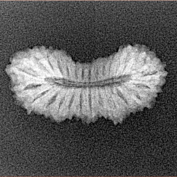 27 Mukhi Rudraksha 23.4mm 1.48gm - Xray