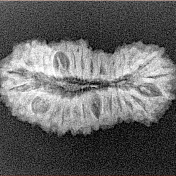 27 Mukhi Rudraksha 26.6mm 2.3gm - Xray