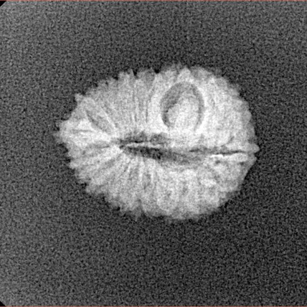 19 Mukhi Rudraksha 16.9mm 1.13gm - Xray