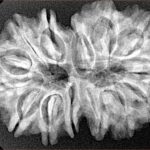 14 Mk Gaurishankar 33.6mm 5.93gm - Xray