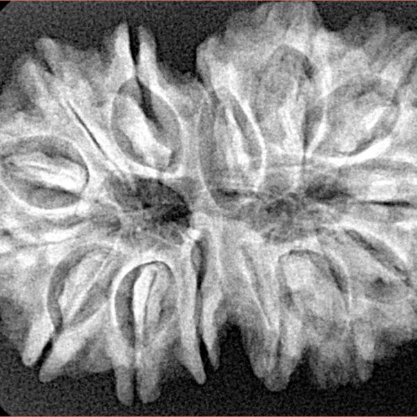 14 Mk Gaurishankar 33.6mm 5.93gm - Xray