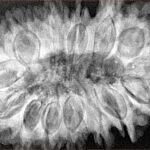 16 Mukhi Rudraksha 38.4mm 8.13gm - Xray