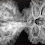 11 Mk Gaurishankar & Ganesh 44.4mm 11.64gm - Xray