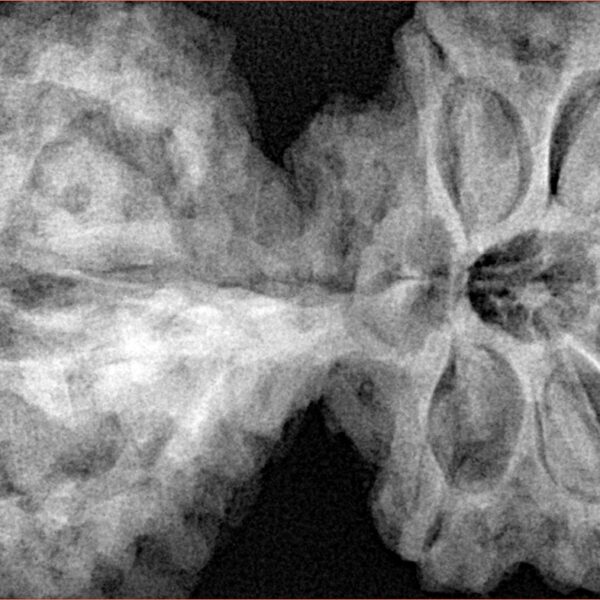 11 Mk Gaurishankar & Ganesh 44.4mm 11.64gm - Xray