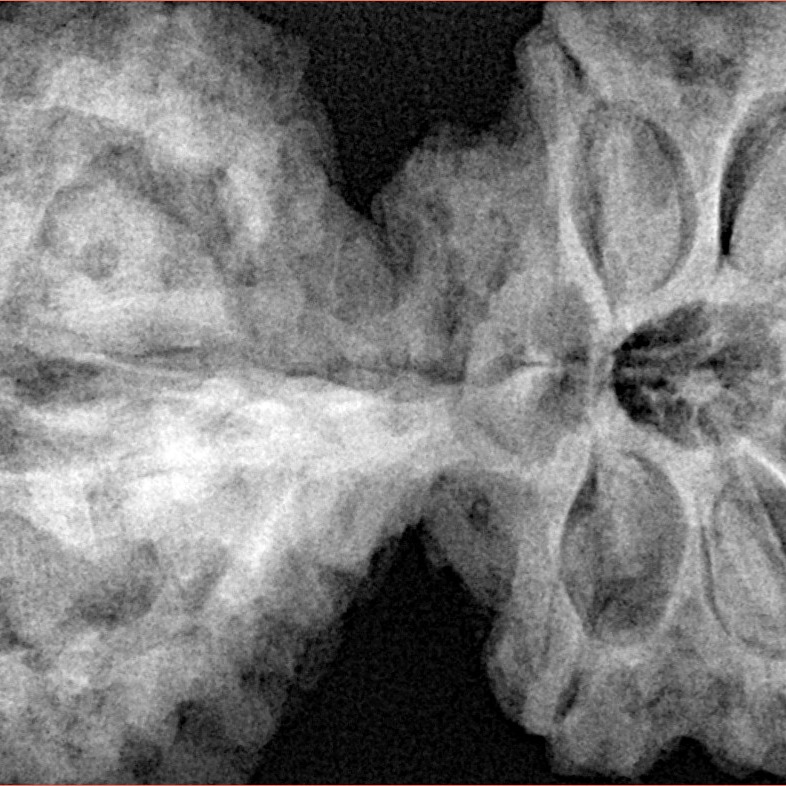 11 Mk Gaurishankar & Ganesh 44.4mm 11.64gm - Xray
