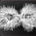14 Mk Gaurishankar 33.2mm 5.56gm - Xray