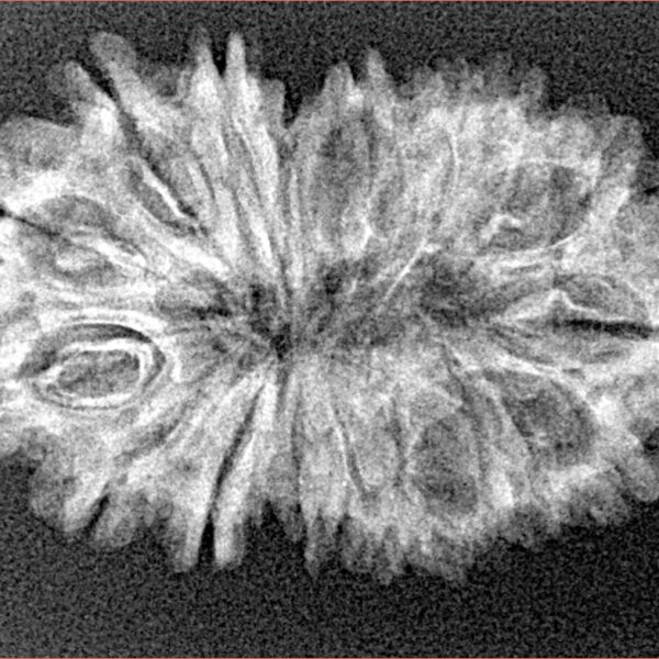 17 Mukhi Rudraksha 30.7mm 3.17gm - Xray