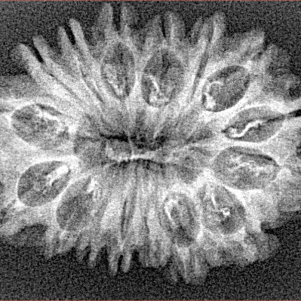 16 Mukhi Rudraksha 29.7mm 2.83gm - Origin: Nepal - Xray