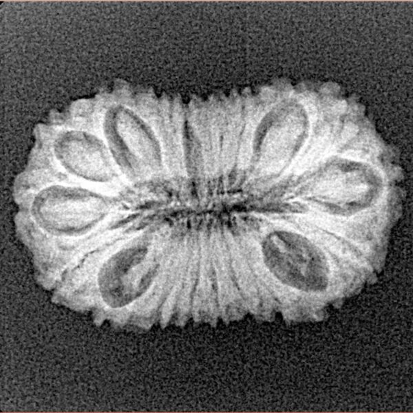 20 Mukhi Rudraksha 24.1mm 2.32gm - Xray