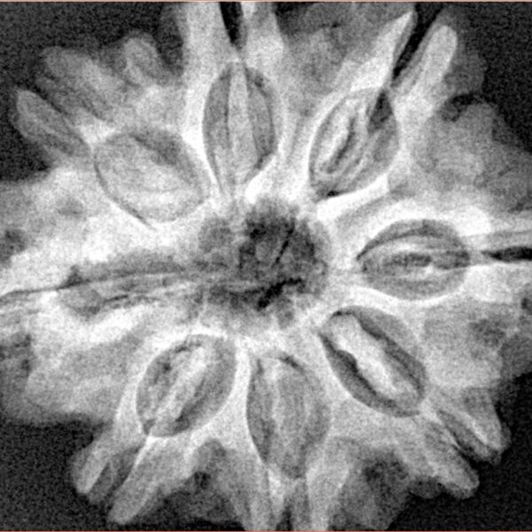 8 Mukhi Rudraksha 29mm 6.68gm - Xray