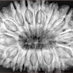 16 Mukhi Rudraksha 35.7mm 9.17gm - Xray