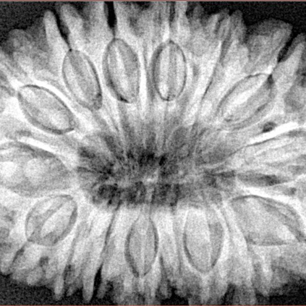 16 Mukhi Rudraksha 35.7mm 9.17gm - Xray