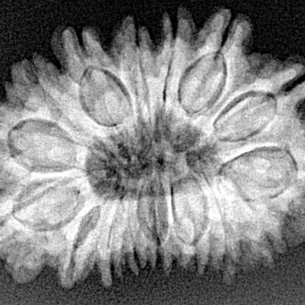 16 Mukhi Rudraksha 31.1mm 5.12gm - Xray