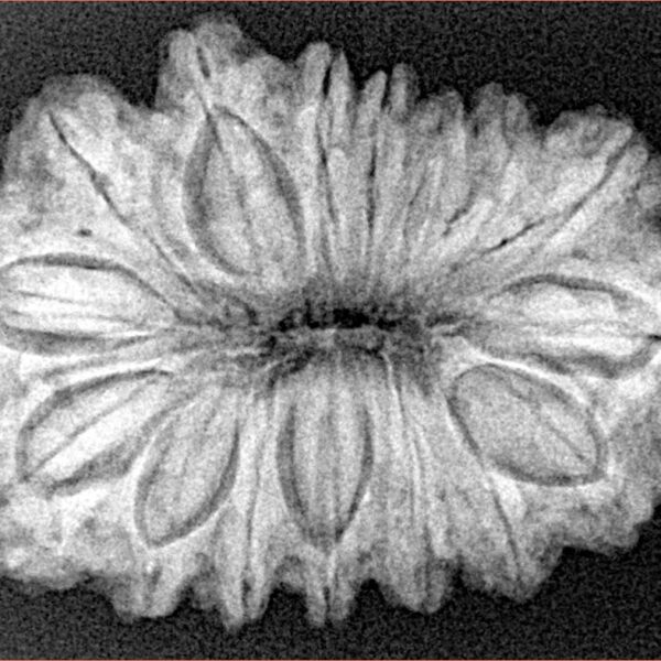16 Mukhi Rudraksha 32.2mm 5.75gm - Xray