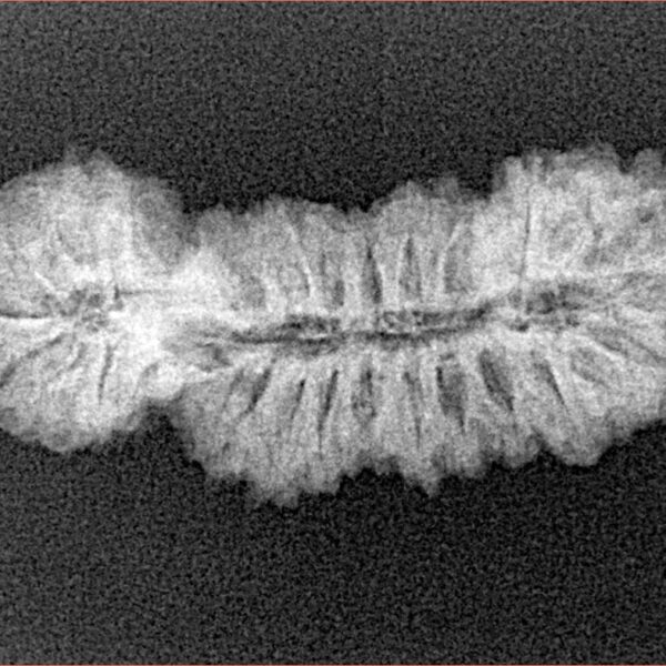 27 MK Gaurishankar 30.4mm 2.68gm - Xray