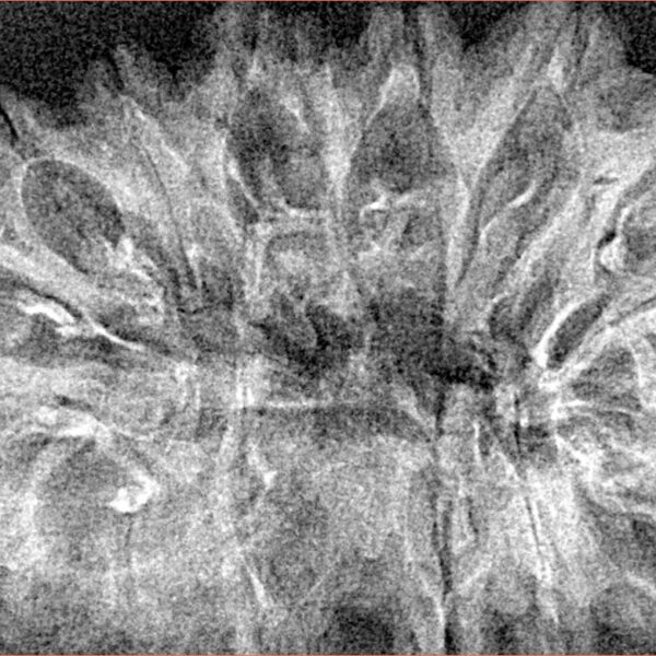 16 Mukhi Rudraksha 40.2mm 3.8gm - Xray