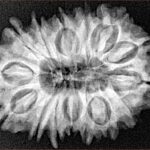 16 Mukhi Rudraksha 27.6mm 4.46gm - Xray
