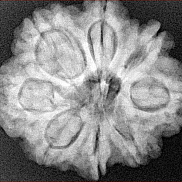 8 Mukhi Rudraksha 27.6mm 6.25gm - Xray